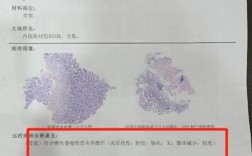 胃溃疡的成因与治疗新进展是什么？