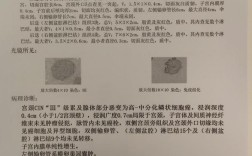 宫颈癌论文参考文献有哪些？