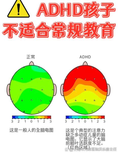 孩子延迟满足能力如何影响未来人生?-图1 孩子延迟满足能力如何影响未来人生?-图1