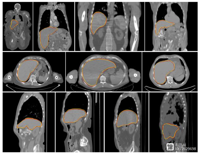 图像隐藏技术如何实现高效安全的信息嵌入?-图3 图像隐藏技术如何实现高效安全的信息嵌入?-图3