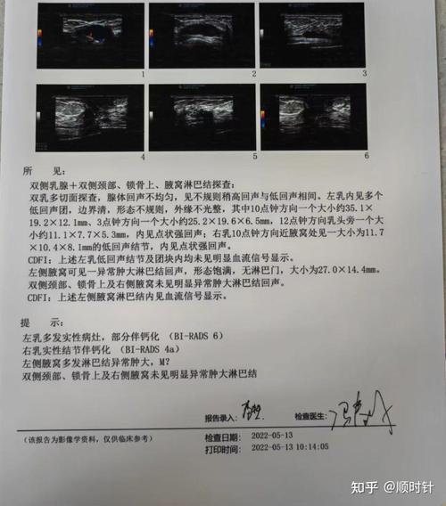 近5年乳腺癌研究有哪些新进展与突破？-图3