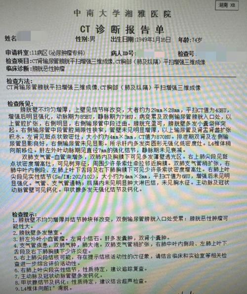 病例对照研究错误点如何快速识别？-图2