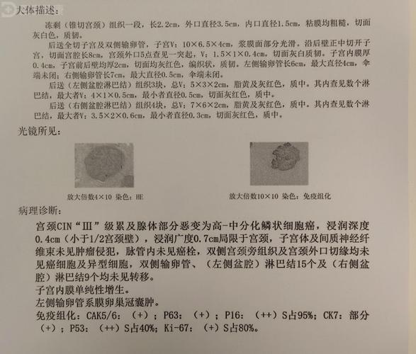 宫颈癌论文参考文献有哪些？-图1