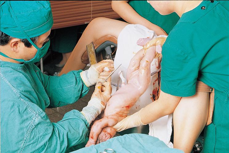 自然分娩视频如何助医学生掌握实操？-图2