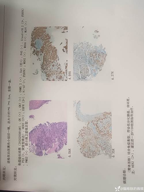 最新唇腭裂参考文献有何新进展?-图2 最新唇腭裂参考文献有何新进展?-图2