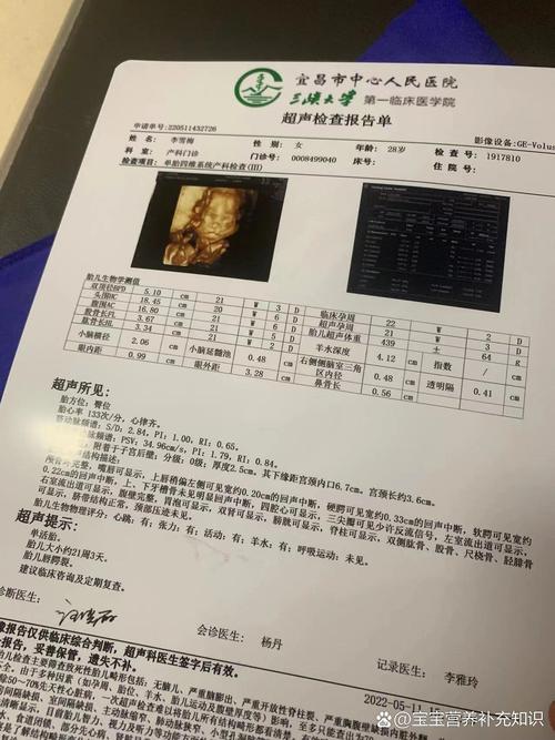 最新唇腭裂参考文献有何新进展?-图3 最新唇腭裂参考文献有何新进展?-图3