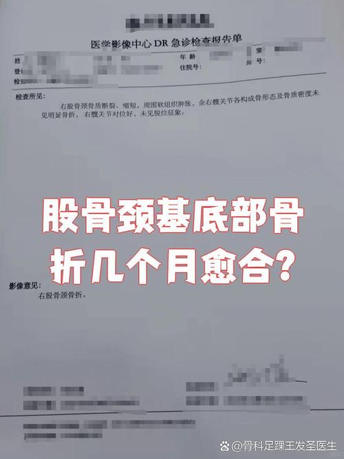 论文股骨颈骨折参考文献-图1 论文股骨颈骨折参考文献-图1