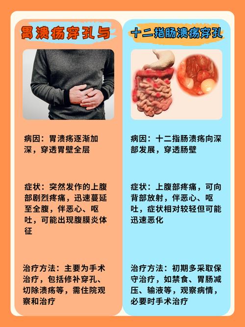 胃溃疡的成因与治疗新进展是什么？-图3