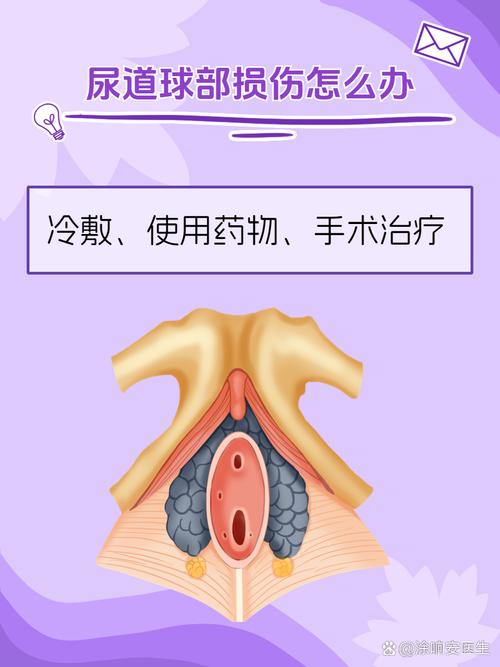 尿道球部损伤如何做好健康宣教？-图1