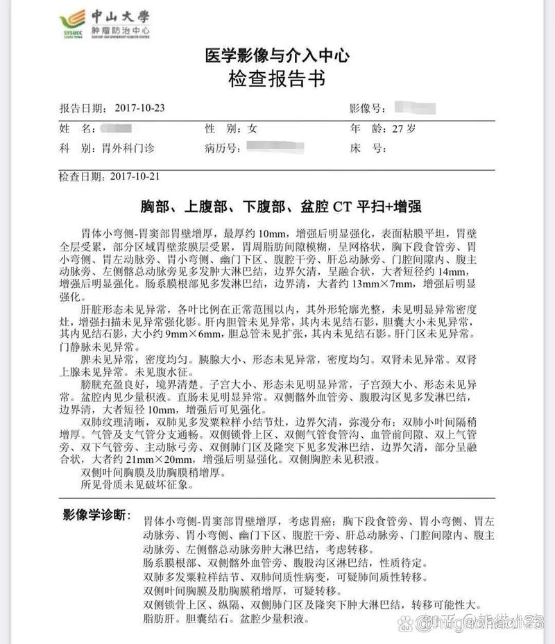 近5年内胃癌参考文献-图1