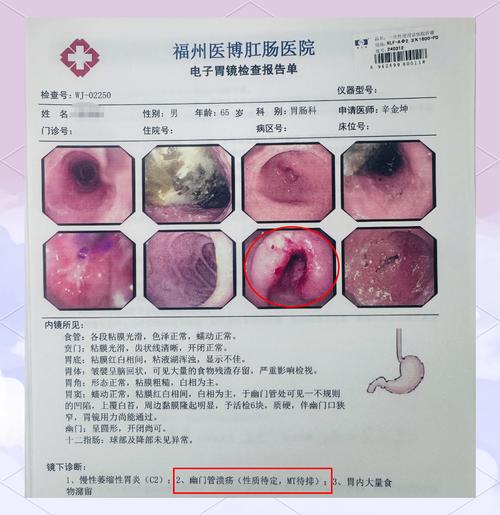 近5年内胃癌参考文献-图3