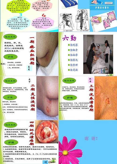 护理学压疮参考文献有哪些关键方向？-图3