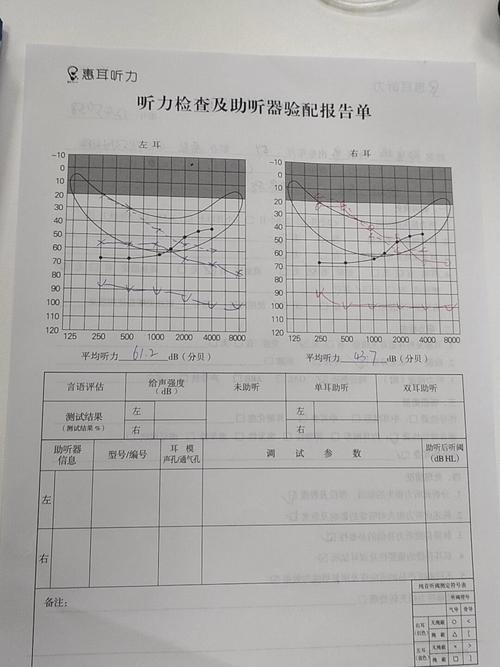 听障儿童心理研究有哪些关键参考文献？-图3