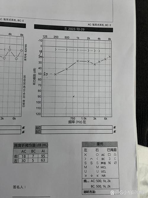 听障儿童心理研究有哪些关键参考文献？-图2