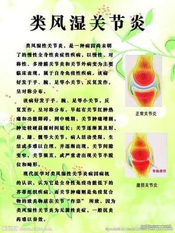 类风湿关节炎参考文献有哪些关键方向？-图2