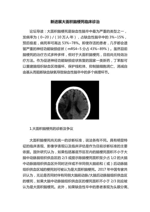 大面积脑梗死研究现状如何?-图2 大面积脑梗死研究现状如何?-图2